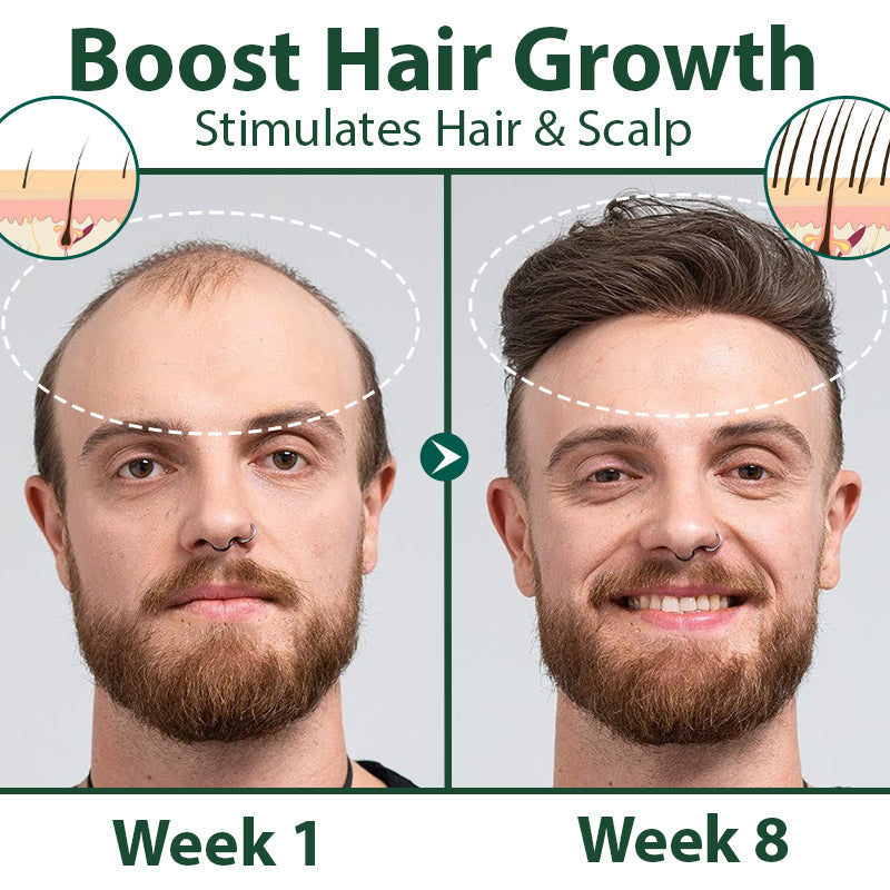 Biancat® HairRegen RedGinseng Spray