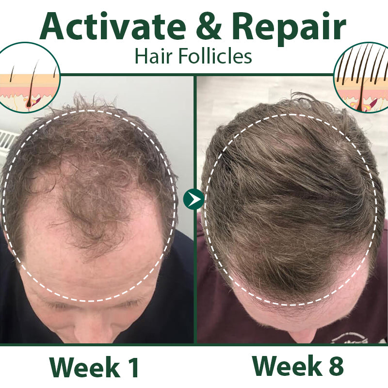 Biancat® HairRegen RedGinseng Spray